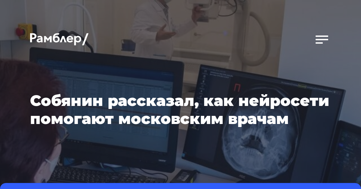 Собянин рассказал, как нейросети помогают московским врачам